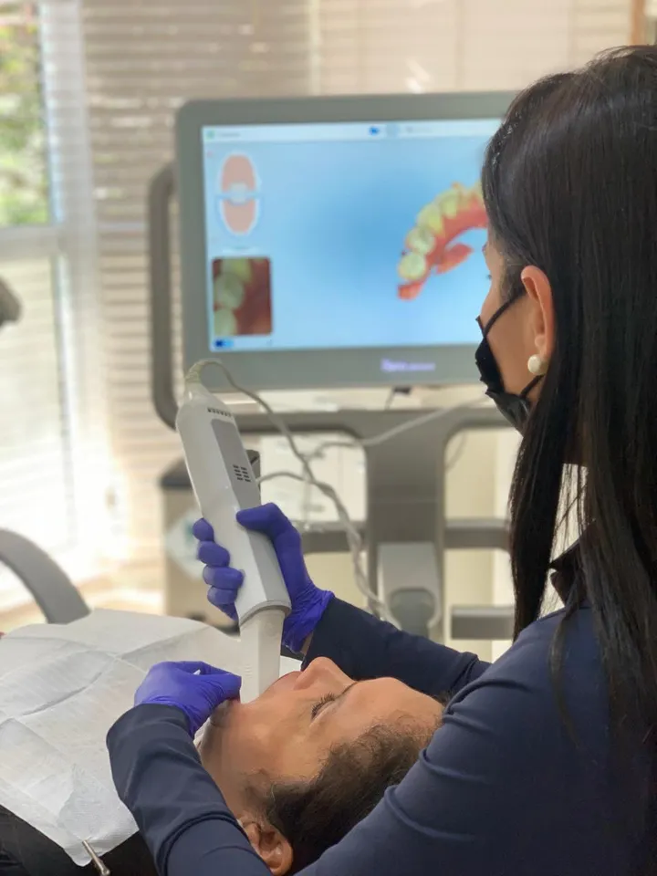 Escaneamento digital para tratamento com aparelho invisível Invisalign
